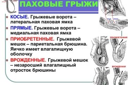 Операція з видалення пахової грижі з сіткою