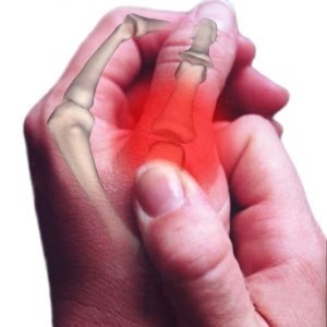 Osteoarthritis tünetek és a kezelés ecsetek kezek