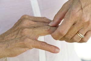 Osteoarthritis tünetek és a kezelés ecsetek kezek