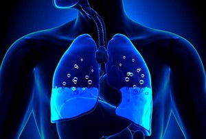 Edem pulmonar, tipurile de edem pulmonar al unui adult, cauzele și consecințele acestei boli și