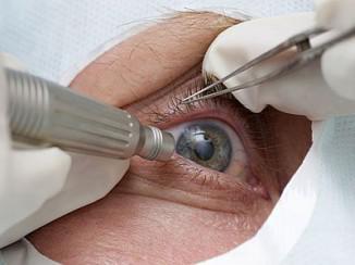 Відшарування сітківки ока причини, симптоми, що це таке, лікування народними засобами,