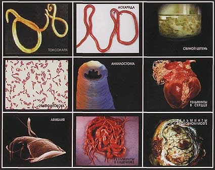 Paraziták az emberi bél férgek (végbélgiliszta), galandféreg, galandféreg, orsóféreg, férgek (férgek)