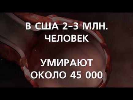 Пневмонія при цукровому діабеті симптоми, лікування і причини