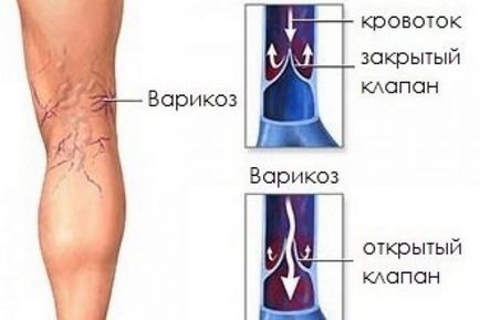 Чому болять ноги після алкоголю