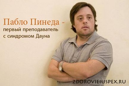 Чому народжуються діти з синдромом дауна і хто винен в цій патології, рецепти здоров'я