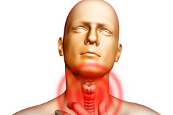 Polyp de simptomele esofagului și de tratament