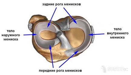 Kár, hogy a hátsó szarv medialis meniscus szakadás vízszintes belső meniszkusz a test 3