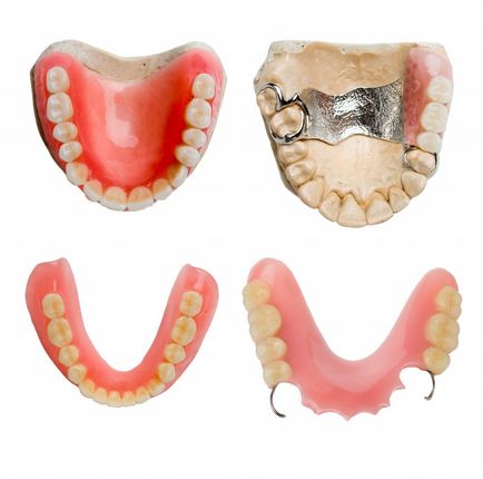 Avantajele și caracteristicile protezei cu clame
