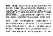 Псевдоневріт псевдозастой) псевдоневріт (псевдозастой) зорового нерва