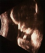 az embrió fejlődése (nap embrió test) Az embrionális fejlődés