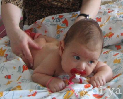Pentru copilul de 2 luni o hernie ombilicală ce să facă sau să facă