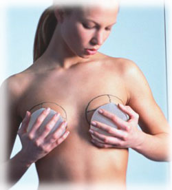 Ревізія грудних імплантатів