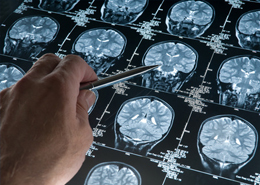 Rezultate de creier - transcriere online, consultație cu un medic