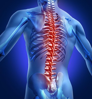 Malformații vasculare ale măduvei spinării - simptome și tratament