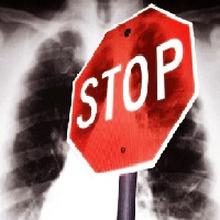 A hőmérséklet tuberkulózis van, és milyen, mint ütni