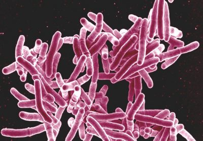 A hőmérséklet tuberkulózis van, és milyen, mint ütni