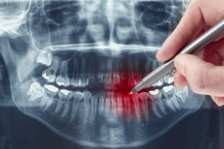 Tipurile și scopul radiografiilor