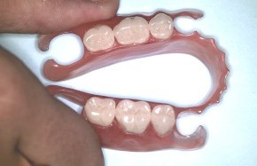Зубні частково знімні протези - ціни в Казані