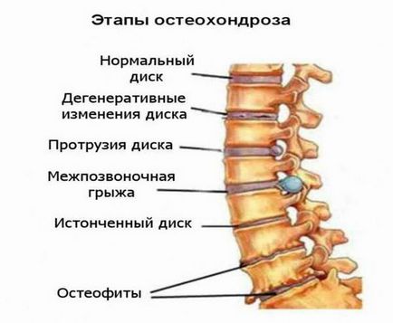 Дзвін у вухах зліва і справа причини і лікування в домашніх умовах, препарати (список ліків)