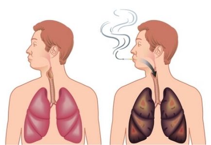 8 Mituri populare despre fumat