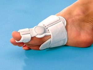 Bursita degetului mare, metode de tratament (deget) Bursita degetului mare, metode de tratament