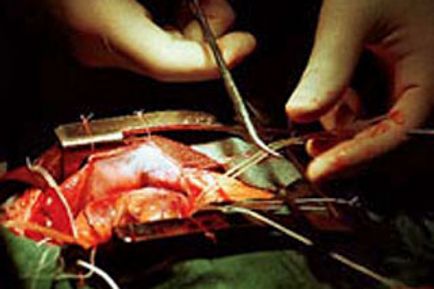 Чорні »трансплантологи - міфи і реальність