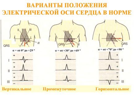 Electrocardiografia (ECG)