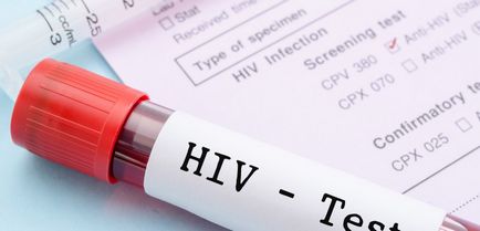 Epidemia HIV din regiunea Tyumen a fost anunțată încă din anul trecut, purtătorul bolii este