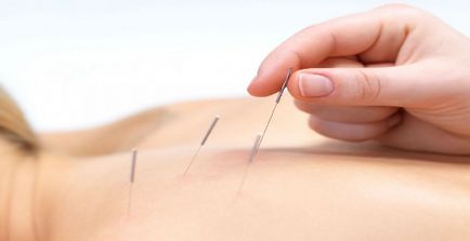 Acupunctura pentru accident vascular cerebral, nevrită a nervului facial