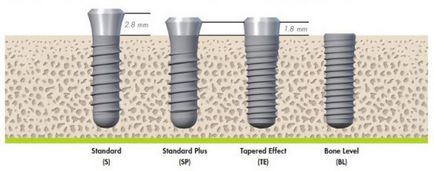 Implanturi straumann