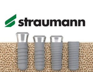 Straumann implantátum típusok és előnyök, árak, fotók