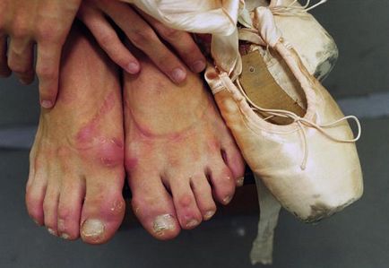 Mi a próbaterhelés egy balerina láb