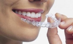 Как правилно да се грижат за зъбите си зад плочата