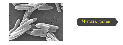 Diagnosticul clinic al tuberculozei