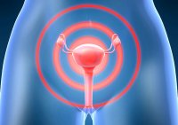Tratamentul eroziunii colului uterin, miomului, candidozelor și vaginitei cu bimunal 9