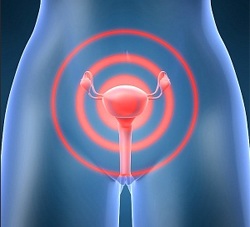 Tratamentul fibromilor uterini