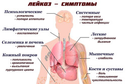 Clasificarea, cauzele, patogeneza și etiologia leucemiei