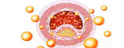 Lipoproteinele - tipurile din sânge, norma, motivele creșterii