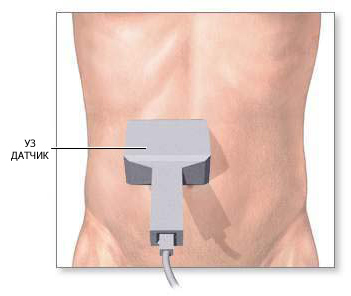 Diagnosztikai módszerek proktológia - ultrahang - Proktológia