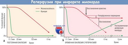 Mecanismele de dezvoltare (patofiziologie) a reperfuziei infarctului miocardic