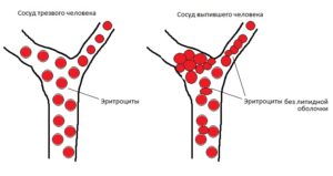 Fie că este posibil un alcool la un herpes (varicela, tsmv)