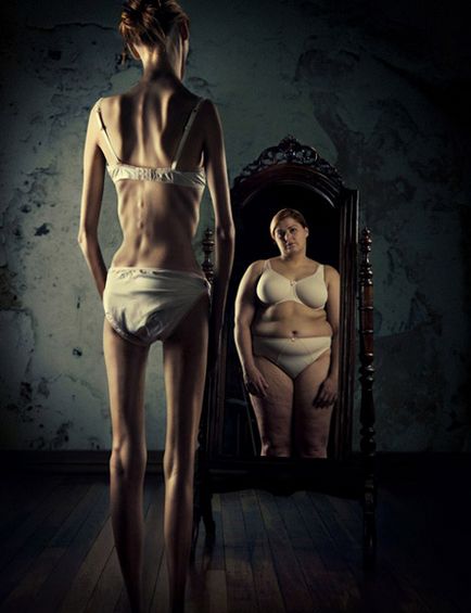 Anorexia nervoasă