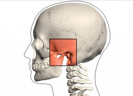 Osteoartrita articulației temporomandibulare - etiologie, clasificare, semne și metode de tratament
