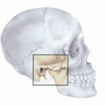 Tratamentul osteoartritei în articulația temporomandibulară