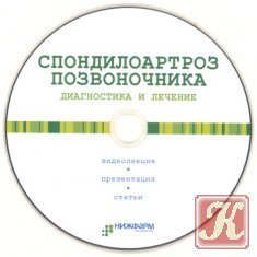 Остеохондроз хребта - симптоми, діагностика та лікування остеохондрозу