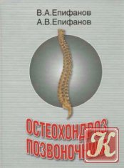 Остеохондроз хребта - симптоми, діагностика та лікування остеохондрозу