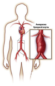 Departamentul de Chirurgie Vasculară Centrul vascular regional al Spitalului Clinic de Urbanism