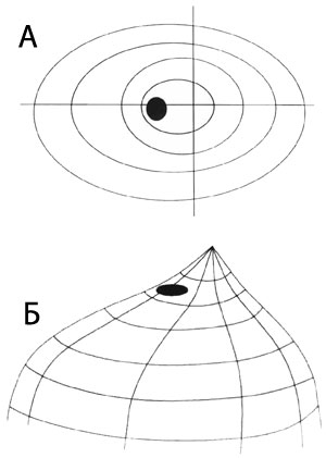 Perimetrie - evaluarea câmpurilor vizuale