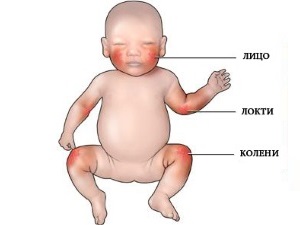 Indicații și metode de aplicare a medicamentului Vitaon baby