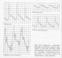 Gyakorlat ellenőrzésére irányuló hemodinamikai sokk, orvos könyvtár